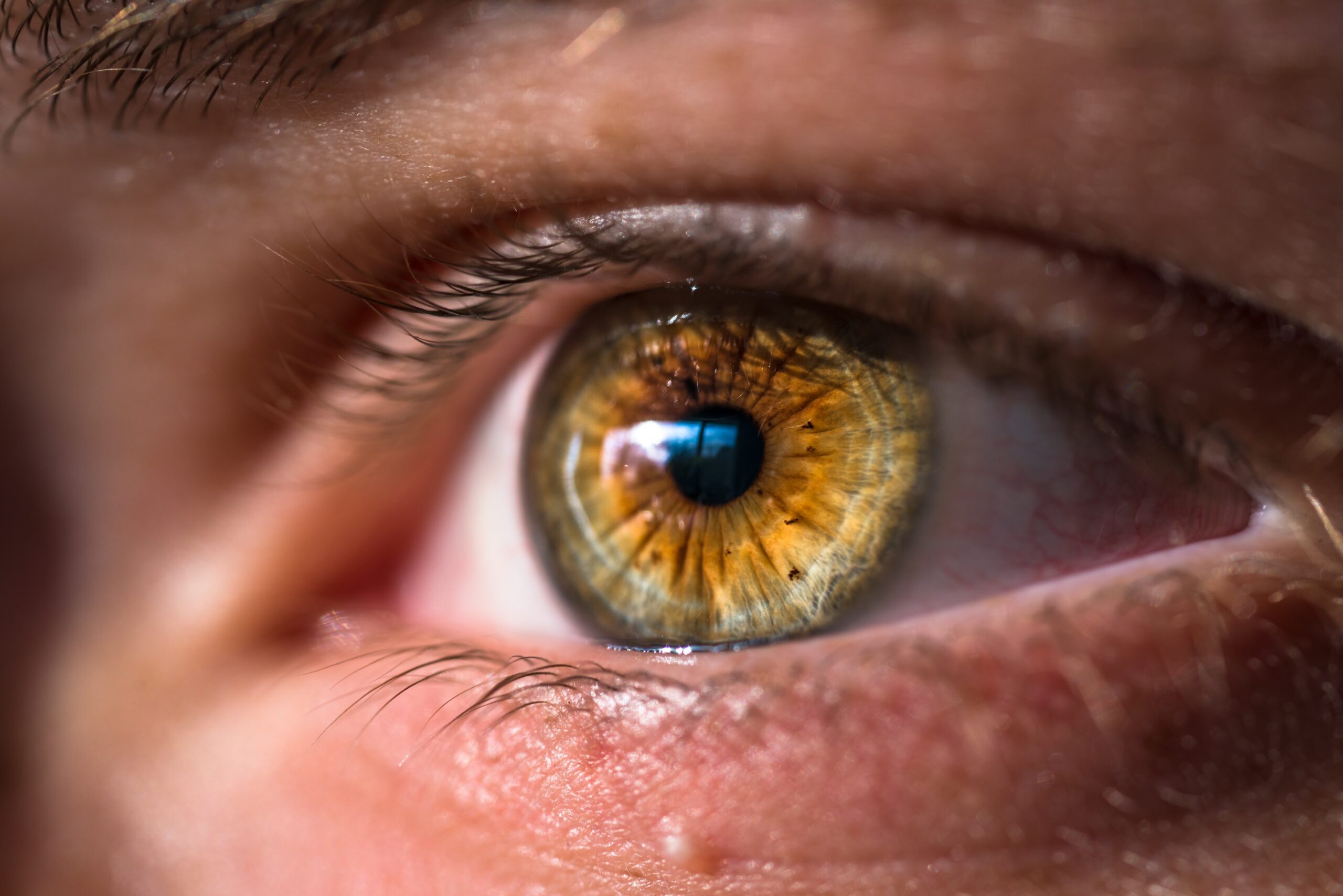 Here’s How Dry Eye Syndrome Treatment Could Work for You